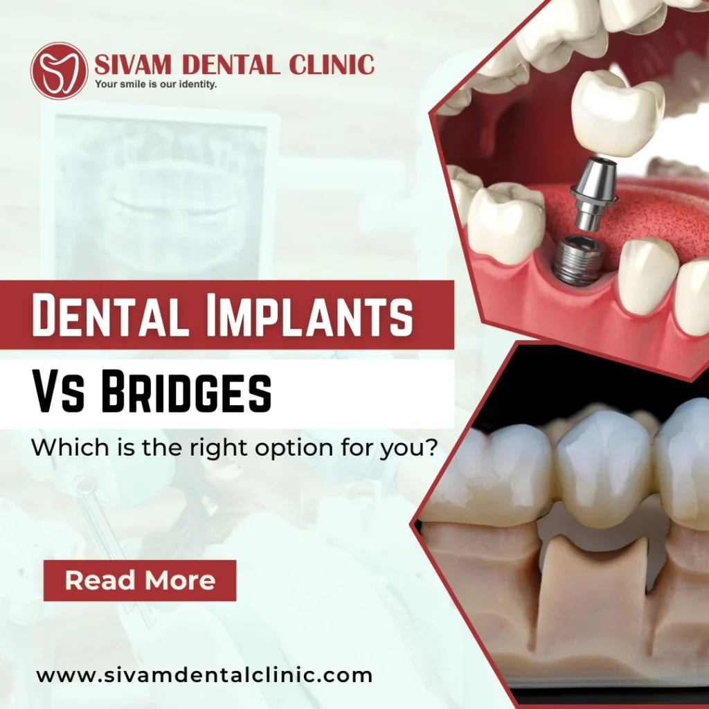 Dental implants and bridges